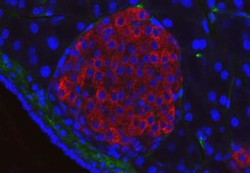 研究确定了与2型糖尿病相关的人类microRNA