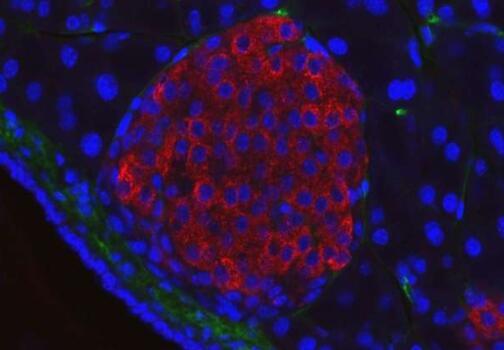 研究确定了与2型糖尿病相关的人类microRNA