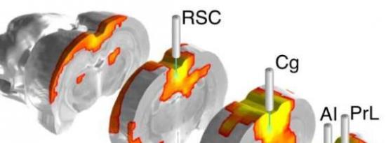 新型光学和功能磁共振成像平台识别控制大规模大脑网络的大脑区域