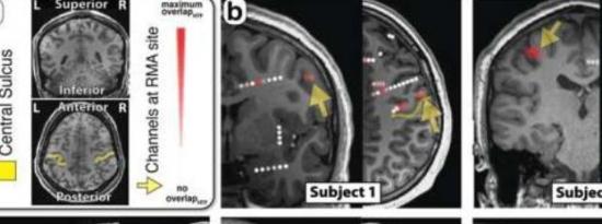 神经科学家发现大脑区域参与运动