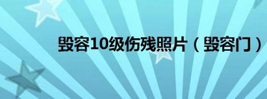 毁容10级伤残照片（毁容门）