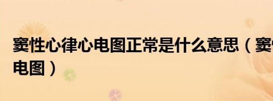 窦性心律心电图正常是什么意思（窦性心律心电图）