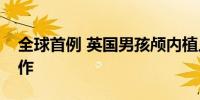 全球首例 英国男孩颅内植入设备控制癫痫发作