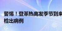 警惕！登革热高发季节到来浙江、广东等多地检出病例